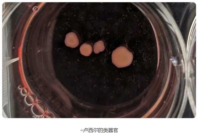 作曲家去世四年后大脑还能编曲？干细胞培育出的大脑有自主意识？