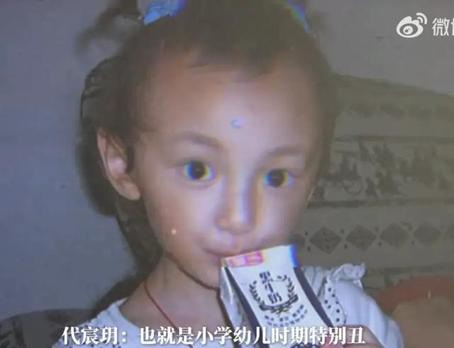 长相完美听障女孩宸玥回应整容：很多人说我长得可怕
