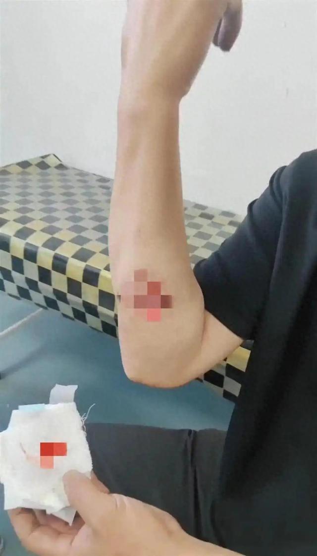 惊险一幕：司机深夜下车方便被狼咬伤，如今狼连车灯都不怕了