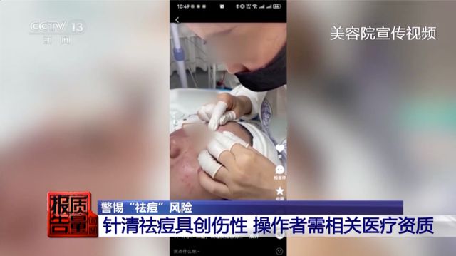 女子美容院祛痘，竟越祛越多！医生紧急提醒→