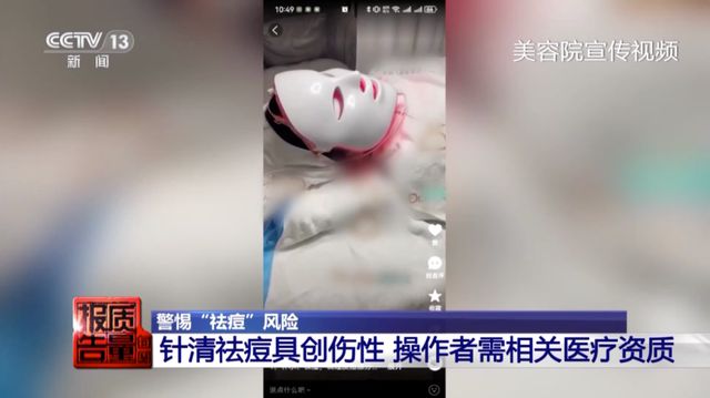 女子美容院祛痘，竟越祛越多！医生紧急提醒→