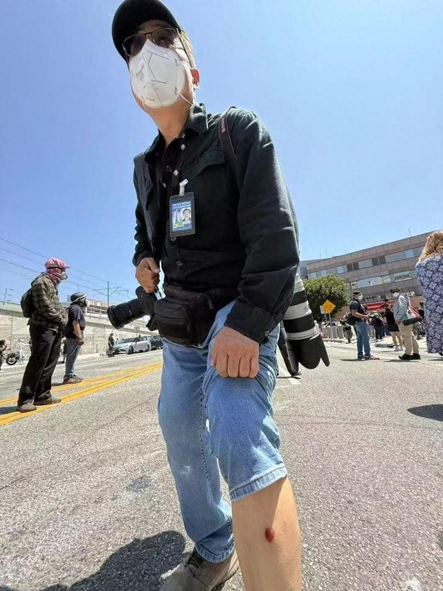 美国洛杉矶警方向抗议人群开枪，新华社摄影被橡皮子弹击中