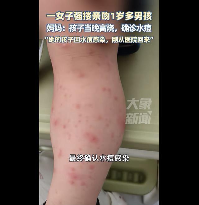 被女子强搂亲吻男孩妈妈最新发声